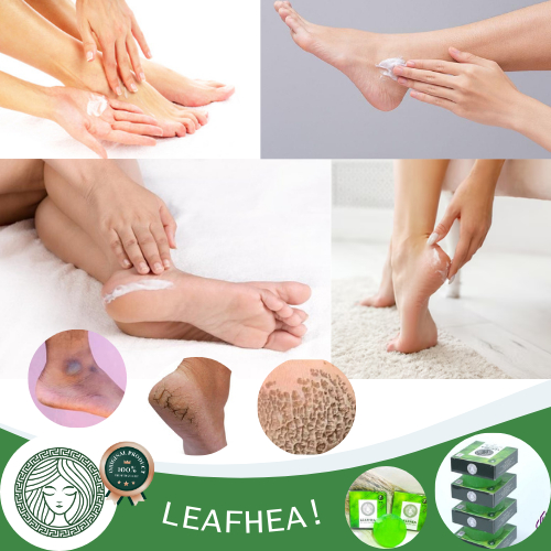 Obat Totol Mata Kaki Hitam Kering Kapalan, Obat Kaki Rayapan dan Bau, Berlubang, Telapak Kaki Pecah 