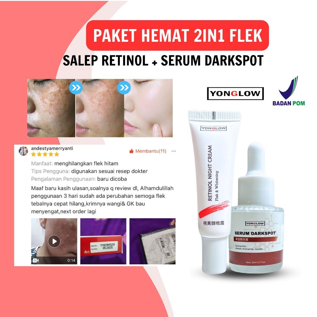 Paket 2in1 Salep Flek Cina dan Serum Flek Cina BPOM Serum Darkspot Yonglow Skincare Serum Penghilang