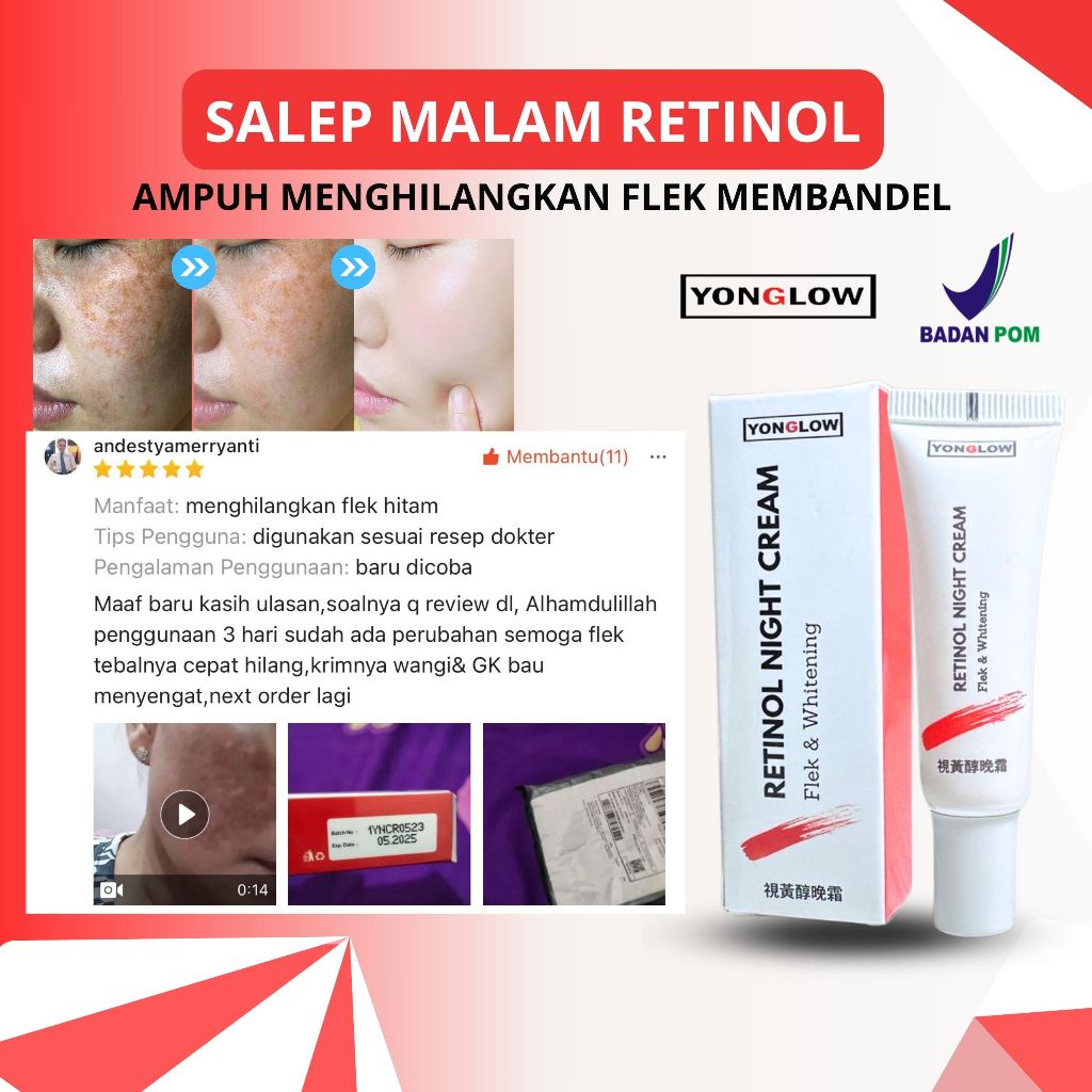 Salep Cina Flek BPOM Yonglow Skincare Salep Retinol Flek Whitening Salep Penghilang Flek Melasma Bin