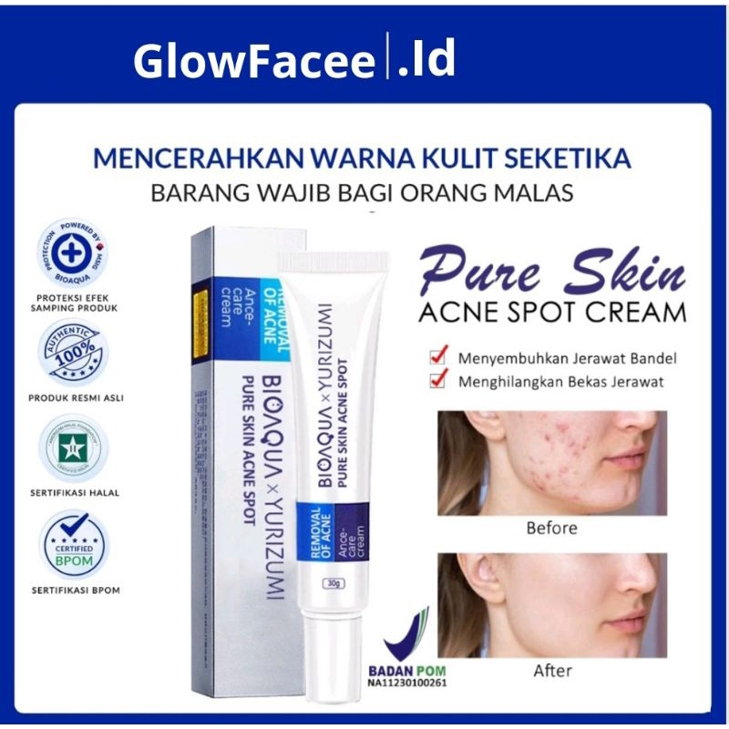 (BPOM) AMPUH Penghilang jerawat pria permanen ASLI Original Obat penghilang bekas jerawat bopeng bru