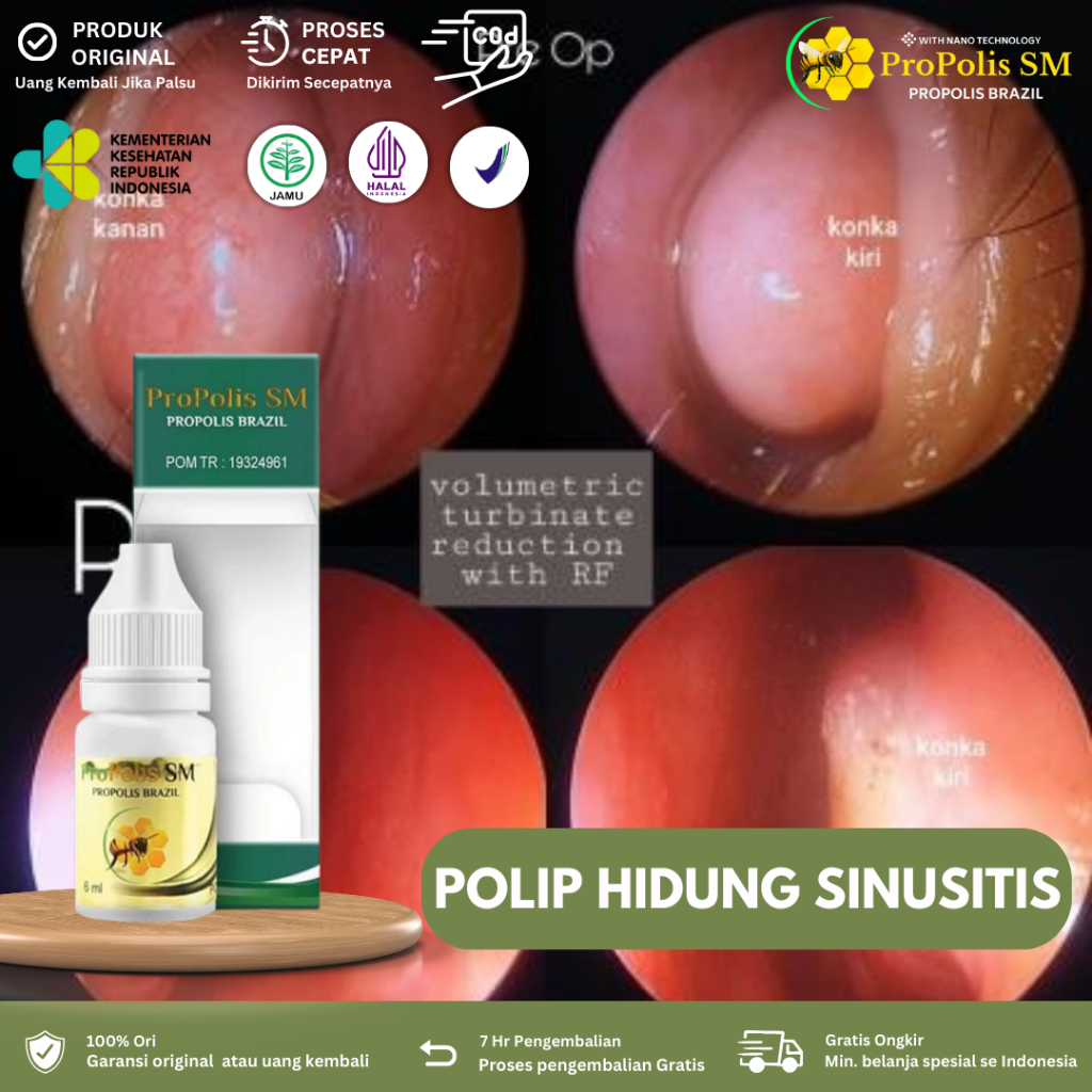 Obat Polip Hidung, Flu Pilek Menahun, Sinusitis, Hidung Bau Busuk, Benjolan Di Dalam Hidung, Pilek B