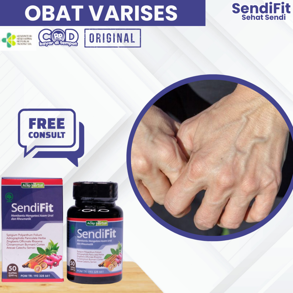 Obat Varises Di Tangan, Obat Penghilang Urat Menonjol Di Tangan, Urat Tangan Menonjol, Obat Urat Ber