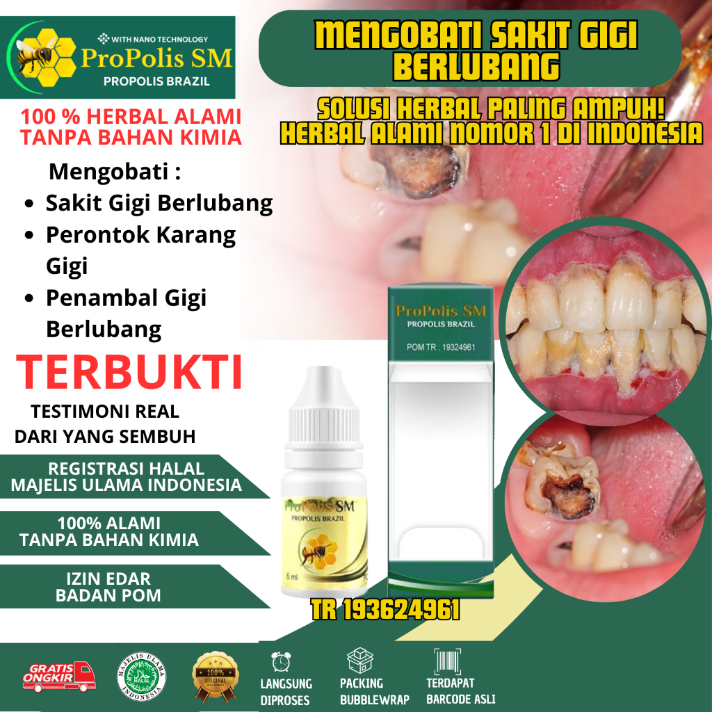 Obat Sakit Gigi Berlubang Perontok Karang Gigi Penambal Gigi Berlubang Propolis Sm Brazilian Asli He