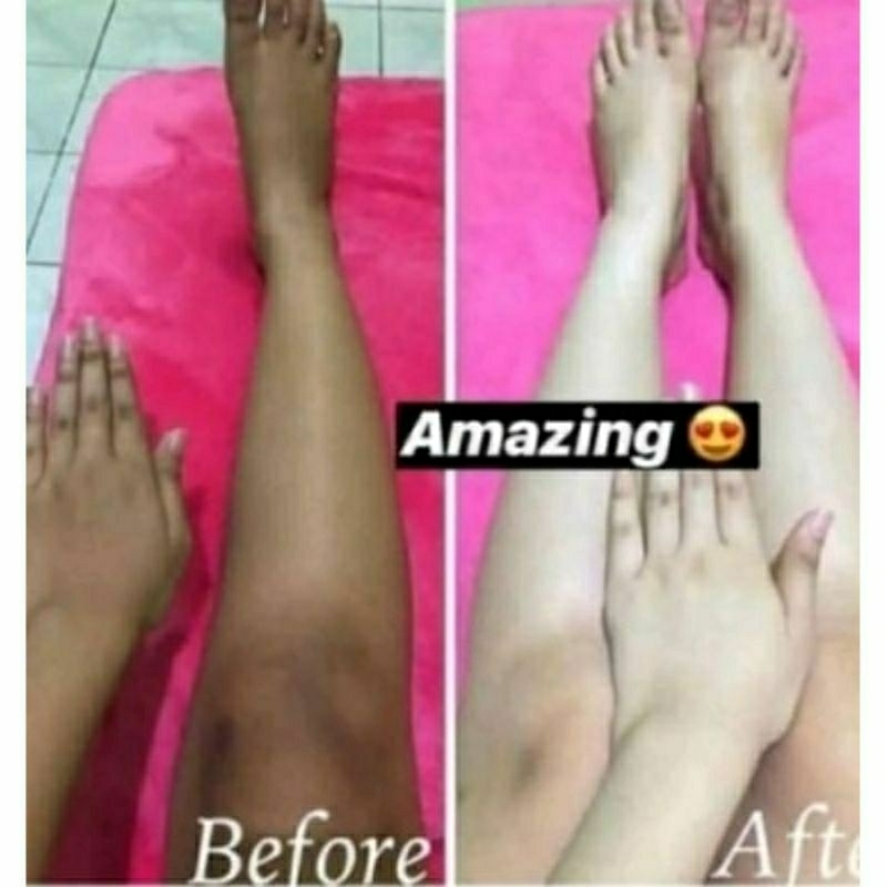 HB super + pelling  pengelupas badan