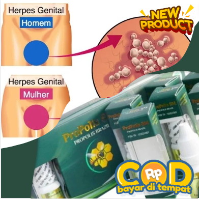 Obat Bintik Merah di Penis Vagina Kelamin Wanita/pria, sifilis, Balanitis, Infeksi Jamur, Raja Singa