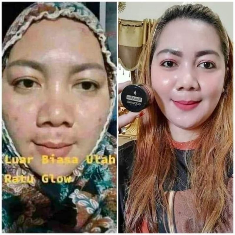 RATU GLOW BRINGTENING DAN FLEK   TONER