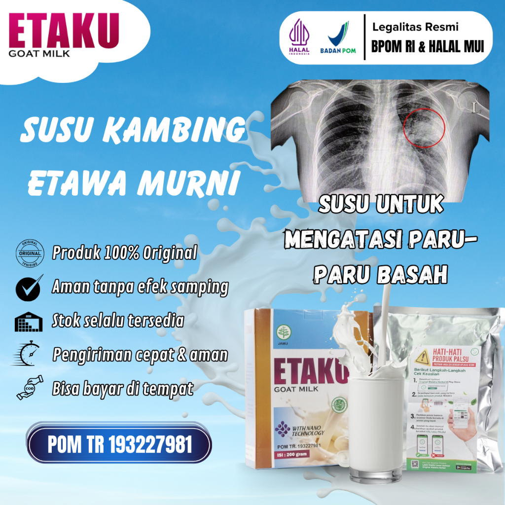 

Walatra Etaku Goat Milk Susu Untuk Paru Paru Basah, Pembersih Paru Paru, Pelega Sesak Nafas, Nafas Terasa Berat