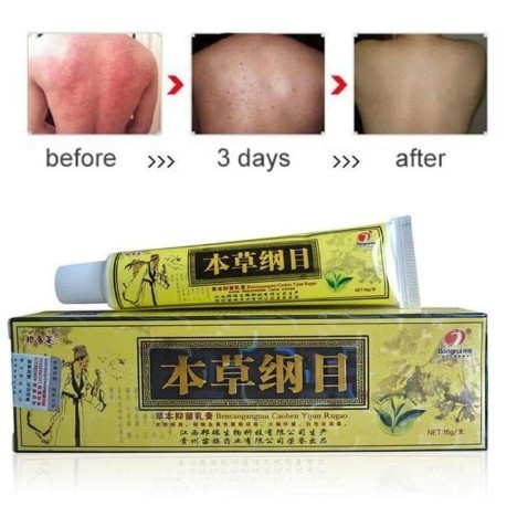 SALEP KUNING EKSIM KERING BASAH AMPUH KULIT PANU KURAP KUTU AIR DAN JAMUR