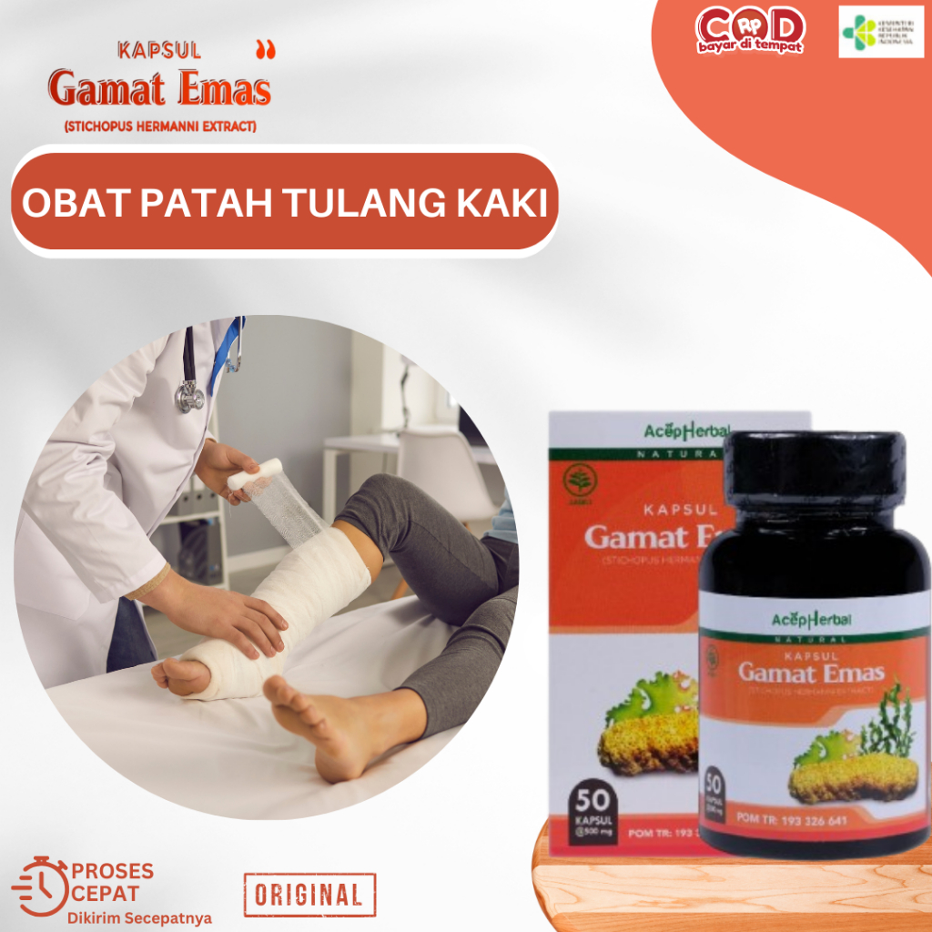 Obat Patah Tulang Kaki, Obat Tulang Retak, Obat Patah Tulang Dan Retak, Obat Patah Tulang Kaki, Obat
