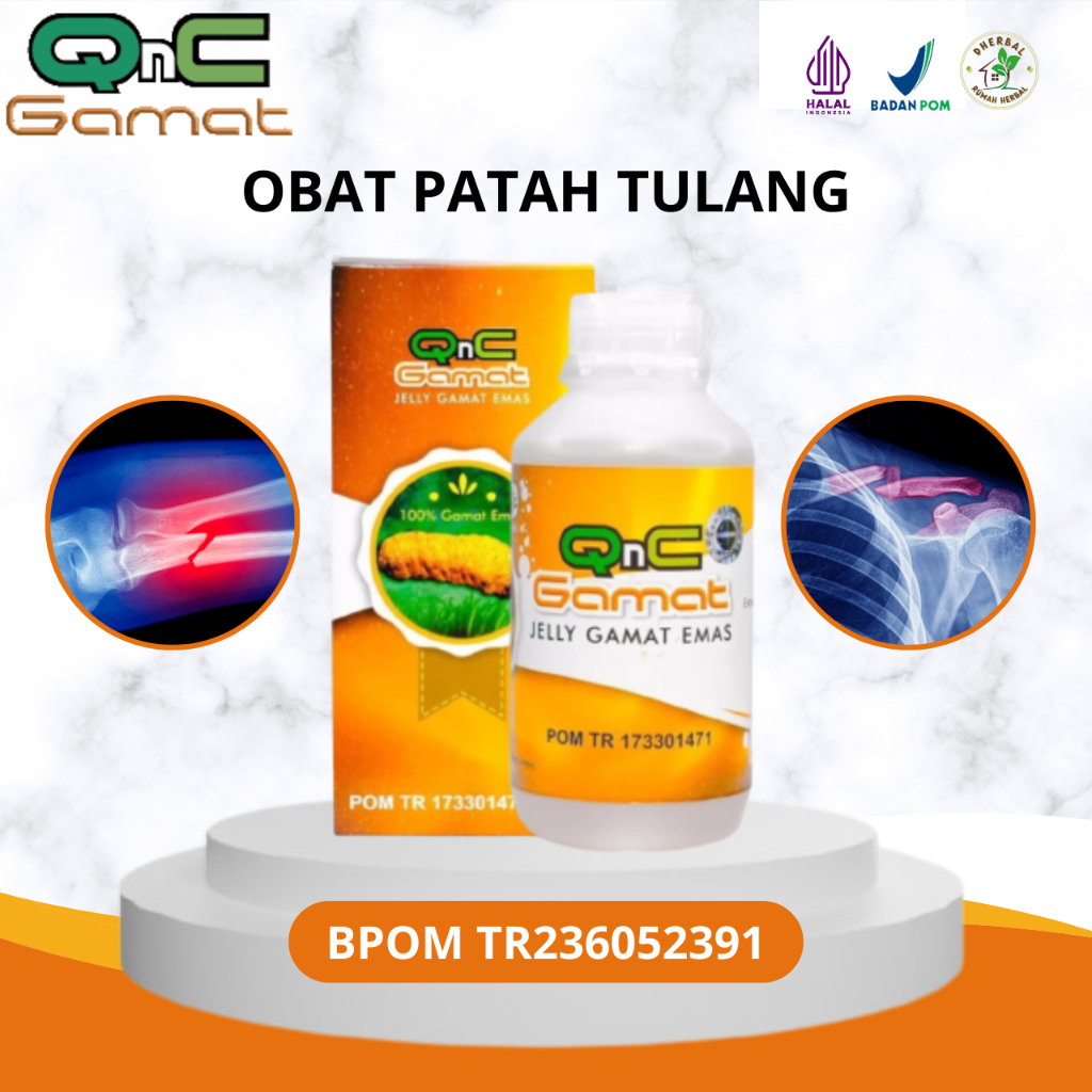 Obat Patah Tulang, Obat Tulang Patah, Obat Tulang Retak, Obat Tulang Remuk, Obat Tulang Keropos, Oba