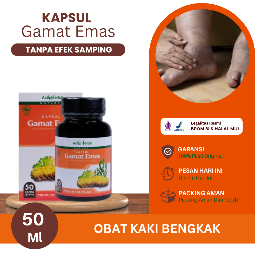 Obat Untuk Kaki Bengkak, Pergelangan Kaki Bengkak, Kaki Bengkak Karena Jatuh, Sakit Kaki Bengkak, Ka
