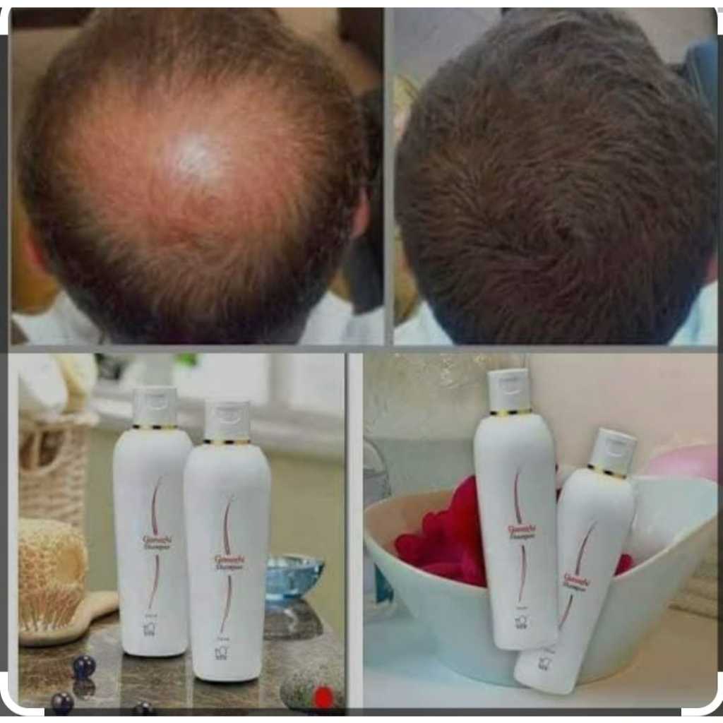 SHAMPO GANOZHI DXN RAMBUT RUSAK RONTOK BERSISIK BERUBAN