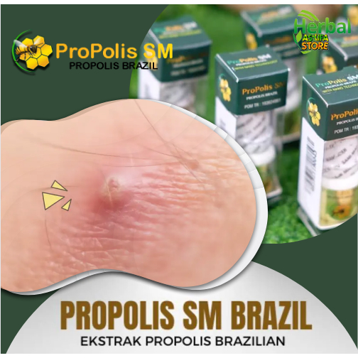 𝐎𝐁𝐀𝐓 𝐁𝐈𝐒𝐔𝐋 - Obat tetes Bisul - Penghilang Gatal - Gatel Bisulan - Obat Bisul di area ketiak, Bisul 