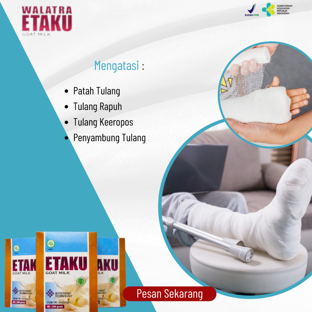 

Susu Untuk Patah Tulang, Susu Kalsium Patah Tulang, Susu Penguat Tulang, Penyambung Tulang Patah, Tulang Retak, Pengapuran Tulang, Tulang Bergeser, Patah Tulang Kaki Dan Tangan, Patah Tulang Karena Jatuh/Kecelakaan Atasi Dengan Etaku Goat Milk 100% Asli