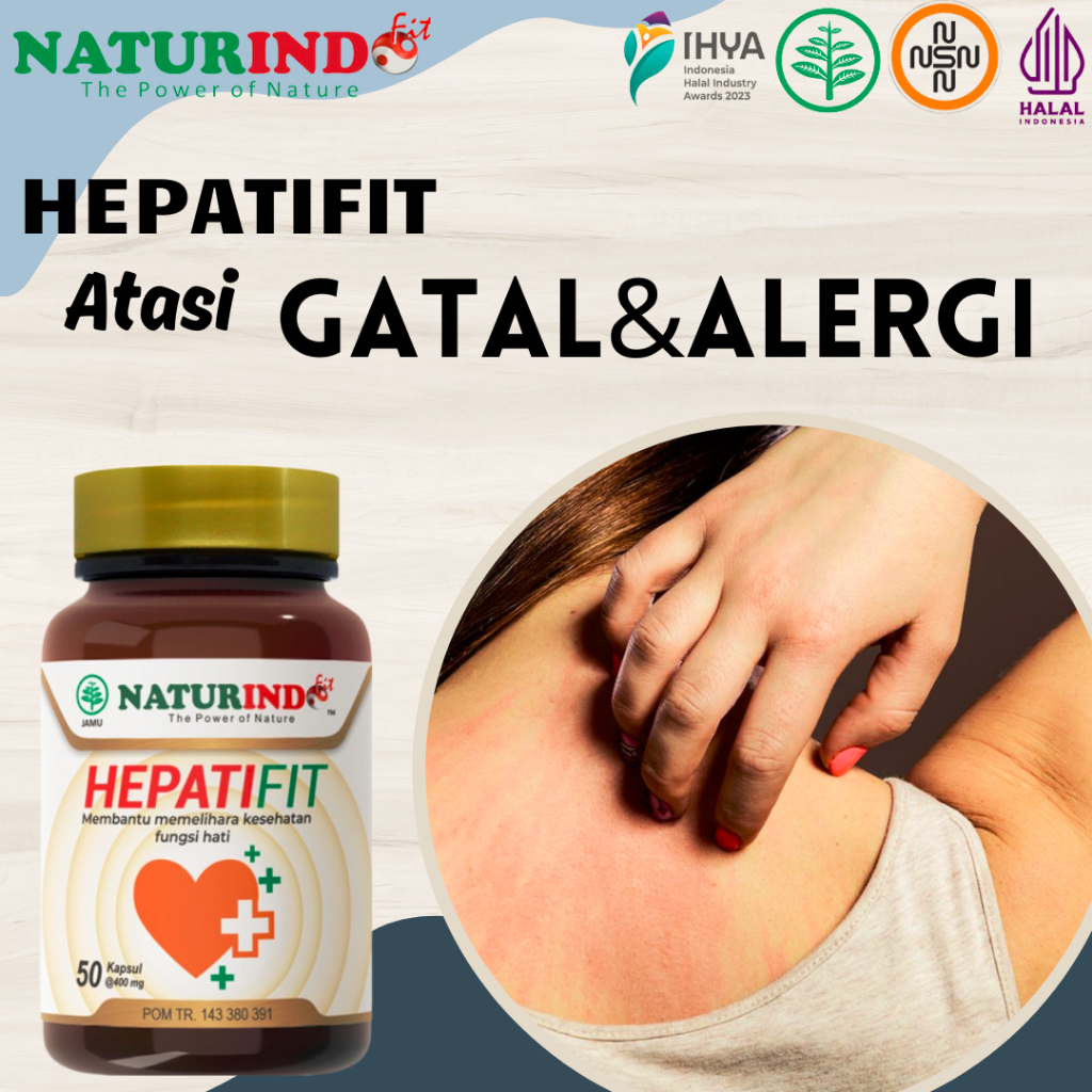 HEPATIFIT OBAT GATAL BIDURAN OBAT ESKIM KURAP KUDIS ALERGI GATAL GATAL HERBAL ALAMI NATURINDO
