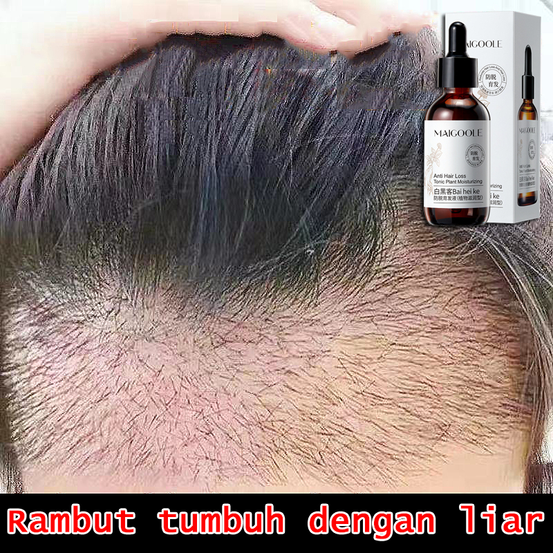 Penumbuh rambut rontok Serum Penumbuh Rambut Anti Botak Penumbuh Rambut 60ml/Hair growth serum Ginge