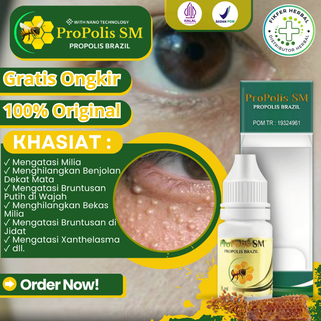 (BISA COD) Obat Penghilang Milia, Obat Benjolan Putih di Bawah Mata, Penghilang Bruntusan Milia, Oba