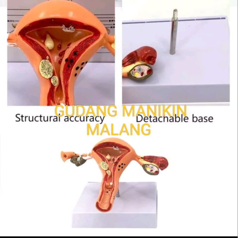 UTERUS UTERUS OVARY ANATOMICAL MODEL PHANTOM/MANIKIN UTERUS