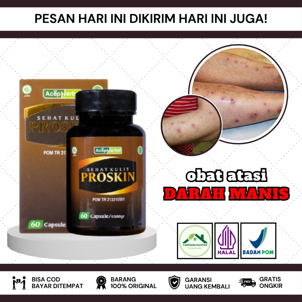 Obat Penghilang Darah Manis, Obat Kulit Darah Manis, Obat Penghilang Bekas Luka Hitam, Obat Kulit Ga
