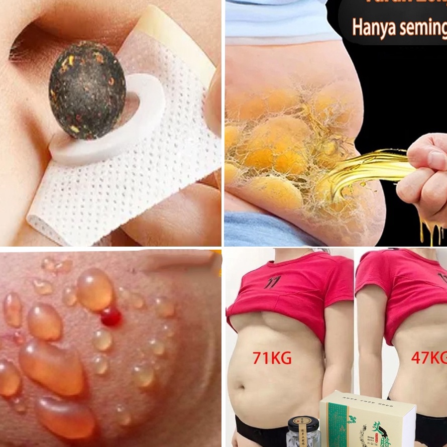 MEGA SALE 1 Ori3pcs Obat Pelangsing Badan Cepat Dan AmpuhSlim Patch Koyo PelangsingAlat Pelangsing P
