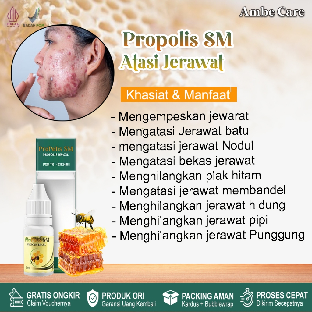 Propolis sm- Obat jerawat,obat penghilang bekas jerawat, jerawat batu,solusi herbal menghilangkan je