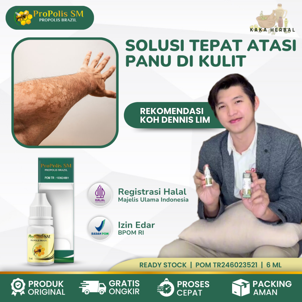 Kaka Herbal - Obat Panu Di Kulit, Obat Herbal Panu, Obat Penghilang Hapur, Obat Panu di Wajah Anak D