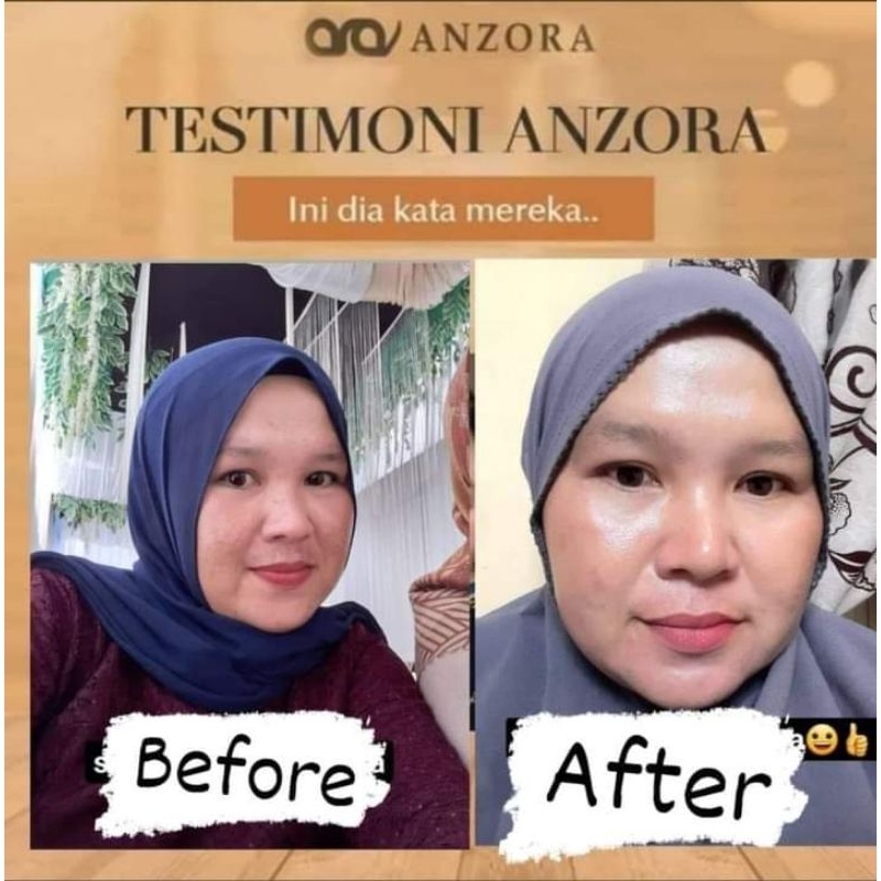 paket Anzora ADS