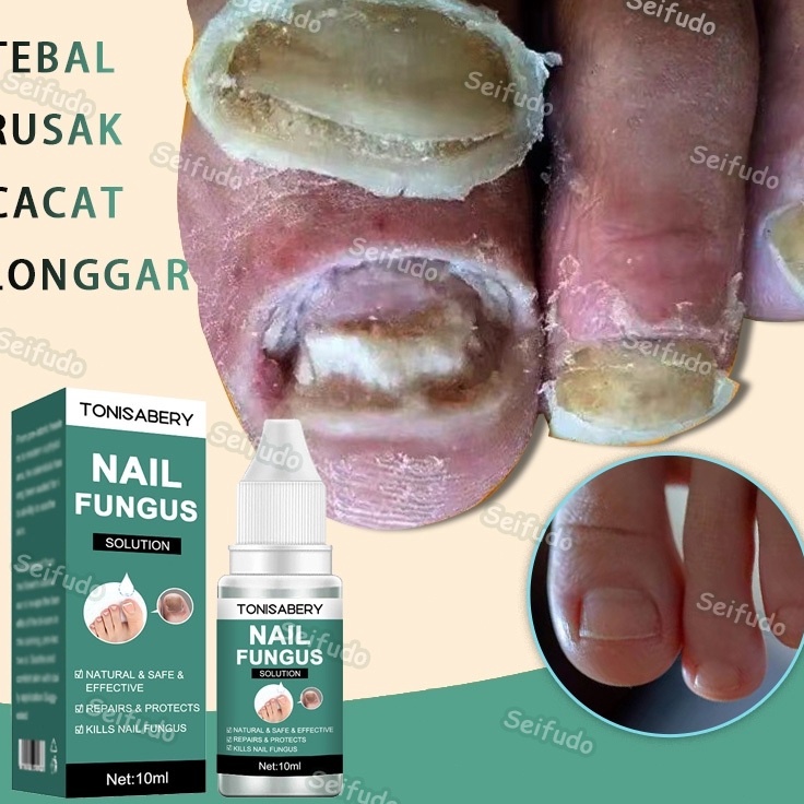 COD BPOMSerum kuku jamur dan rusak obat kuku jamur dan rusak obat jamur kuku 1ML obat kuku rusak pal