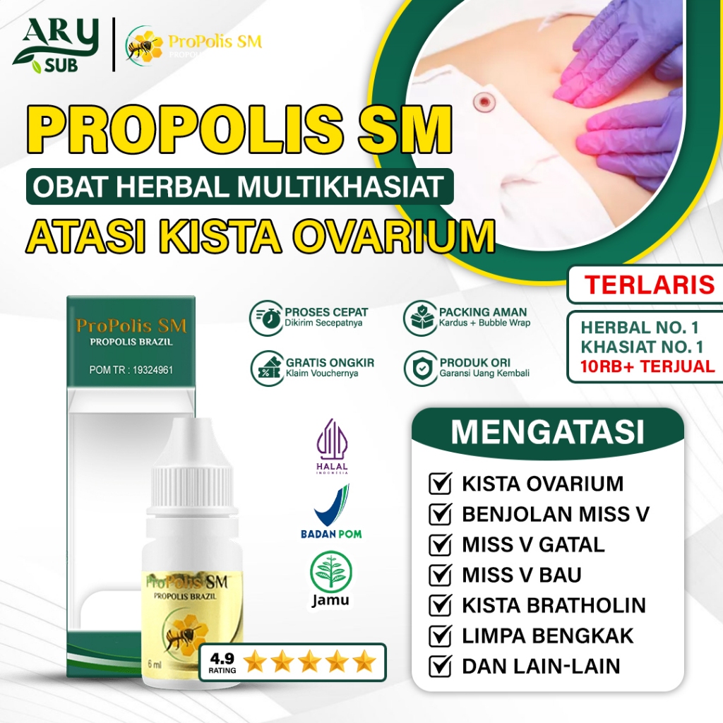 Obat Kista Ovarium - Kista Indung Rahim - Kista Coklat - Kista Bartholin - Miom Herbal Propolis SM