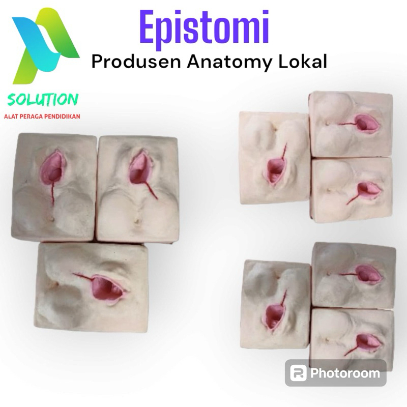 Alat Peraga Episiotomy Lokal bahan Silikon/phantom /manikin/anatomi/epistomi