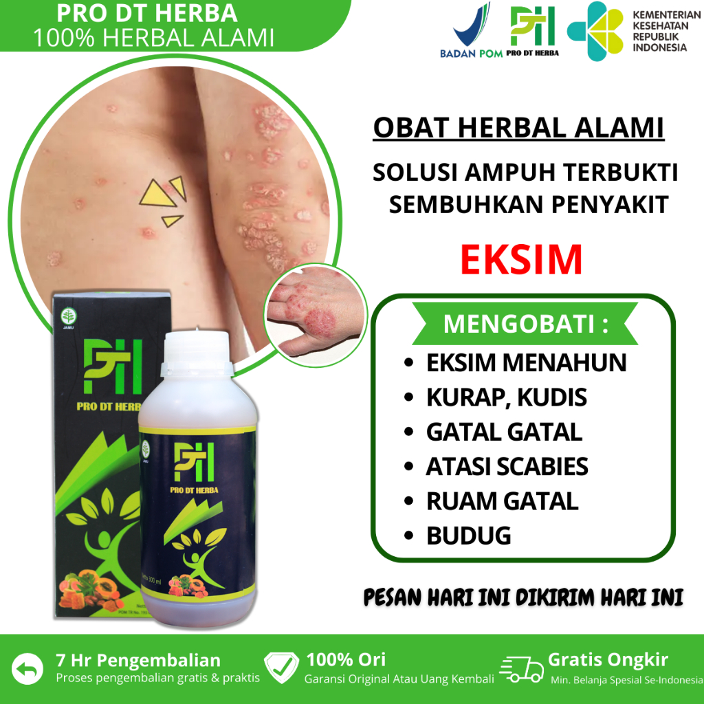 Obat Eksim Kering Menahun Eksim Basah Eksim Kering Gatal Eksim Gatal Kulit Obat Jamur Kulit