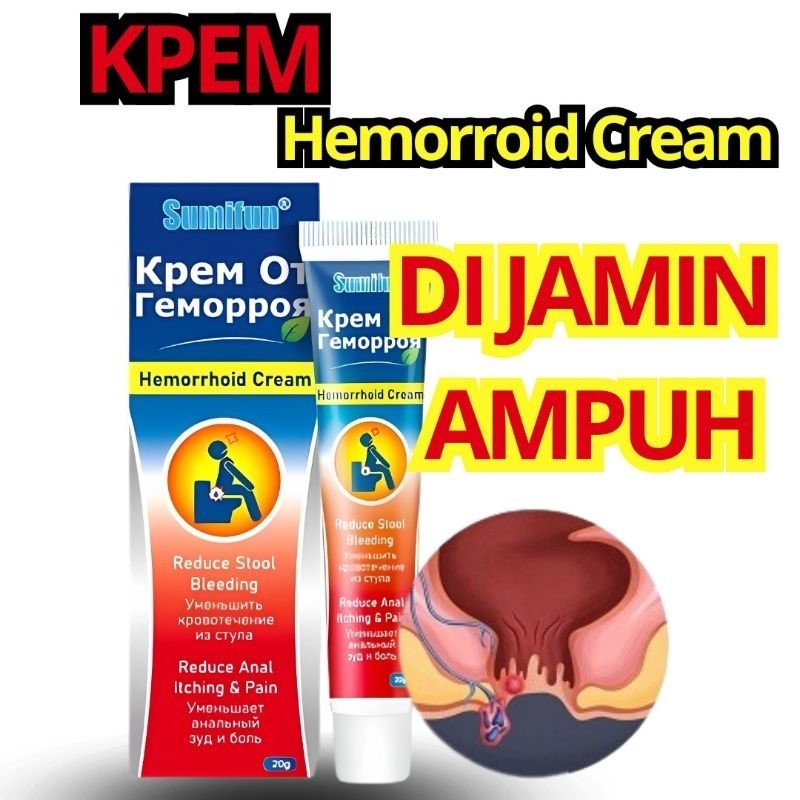 Obat Salep Wasir Ambeien Salep Ambeien sangat ampuh