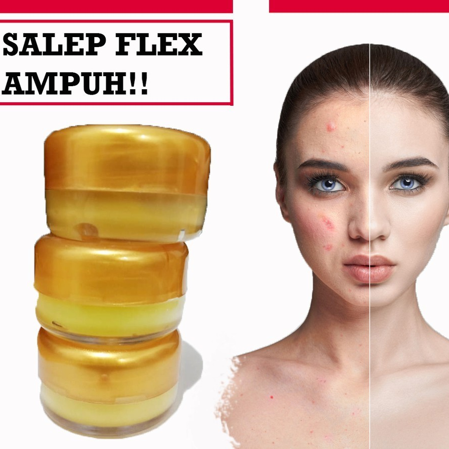 COD  Salep Melasma Flek Hitam Membandel Ampuh Menghilangkan Flex Hitam Dan Jerawat
