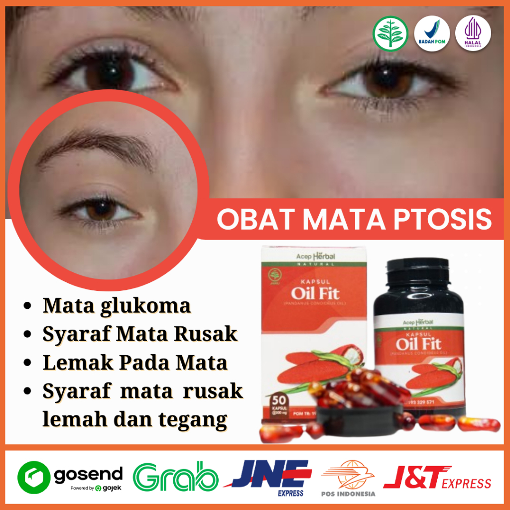 Obat Mata Ptosis, Obat Mata Beda Sebelah Kiri & Kanan,Obat Kelopak Mata Turun Sebelah, obat Mata