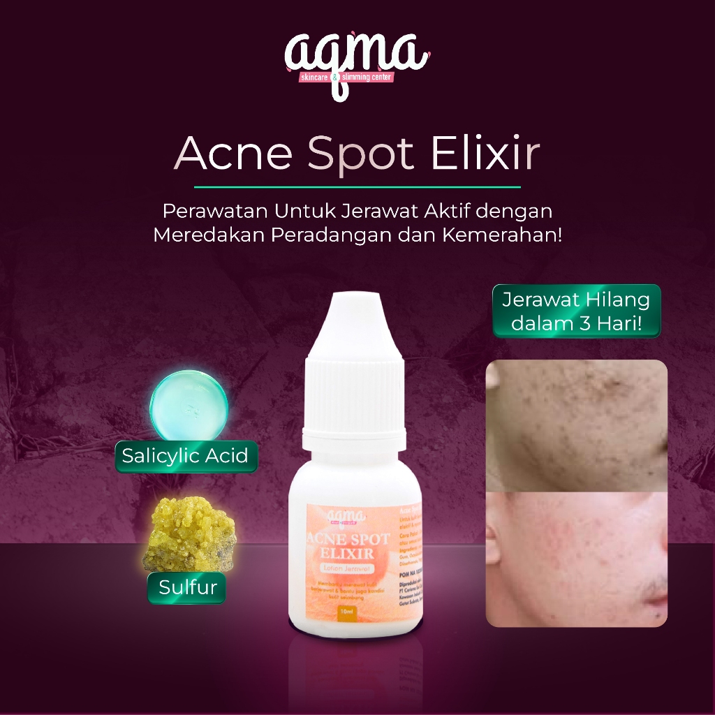 AQMA SKINCARE - Acne Spot Elixir 10ml / Lotion Jerawat Pertama yang Menghilangkan Jerawat Hanya dala