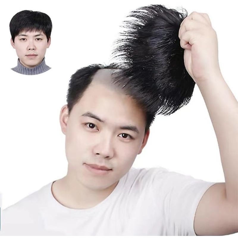 WIG TOUPEE PRIA / RAMBUT PENUTUP BOTAK PRIA KOREA