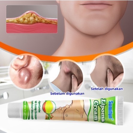 SUMIFUN LIPOMA CREAM SALEP HERBAL