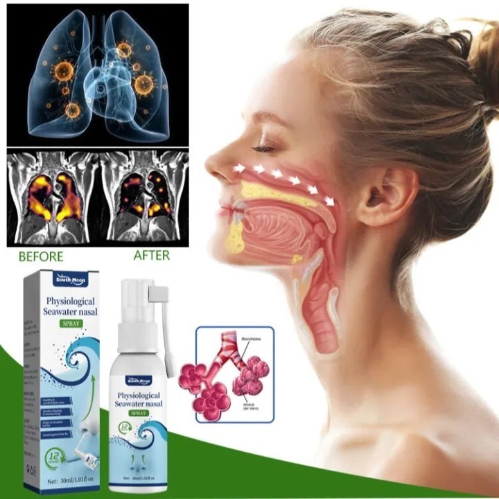 NEW Obat Semprot Sinusitis Obat Sinusitis Semprotan Hidung Paling Ampuh Spray Terapi Kesehatan