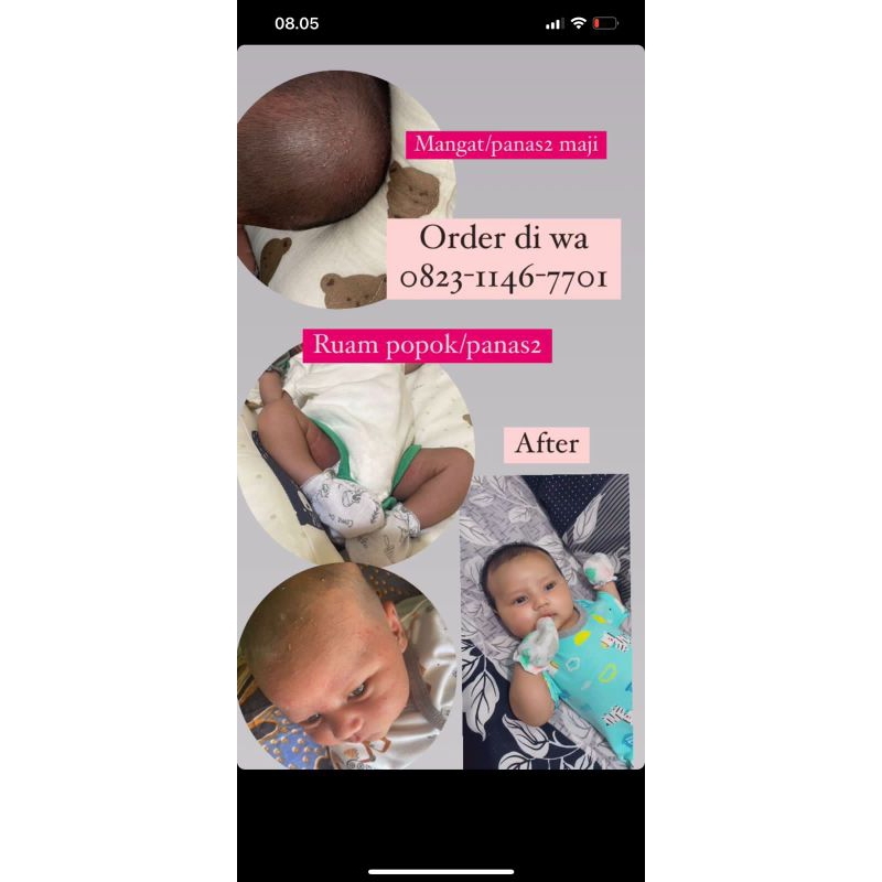 Salap multifungsi bisa untuk kulit gatal