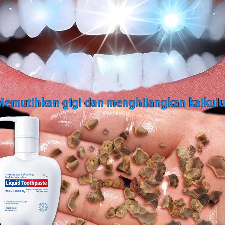 ORIodol pemutih gigi dan karang gigi dan penghilang karang gigi  alat pembersih karang gigi  karang 