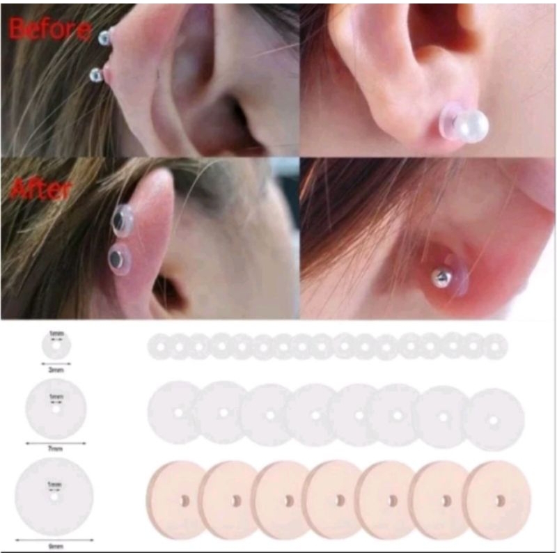 nopull piercing/obat tindikan keloid