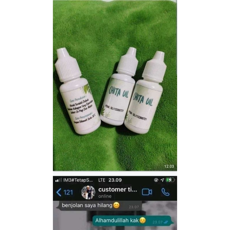chita oil penghilang benjolan ampuh 100 persen