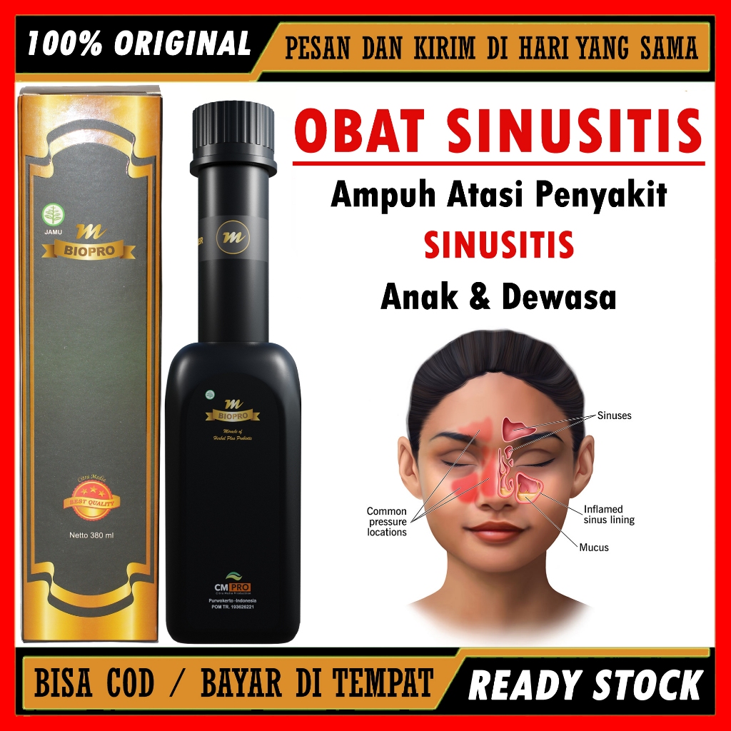 Obat Sinusitis Kronis Anak & Dewasa Sinusitis Menahun, Sinusitis Akut Paling Ampuh Mbiopro Herbal