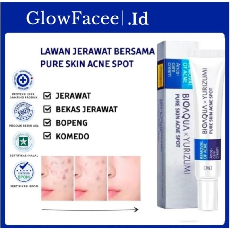 Salep jerawat Gatal Paling Ampuh 20g psoriasis paling ampuh Salep Kulit Gatal Dermatitis Jamur Anti 