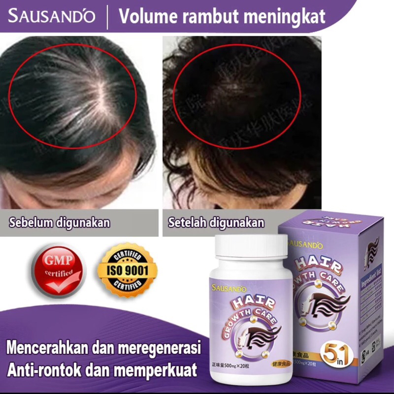 SAUSANDO Penumbuh Rambut Kapsel Shengfa /Orang dewasa hanya butuh 7 hari untuk hasil cepat untuk pri