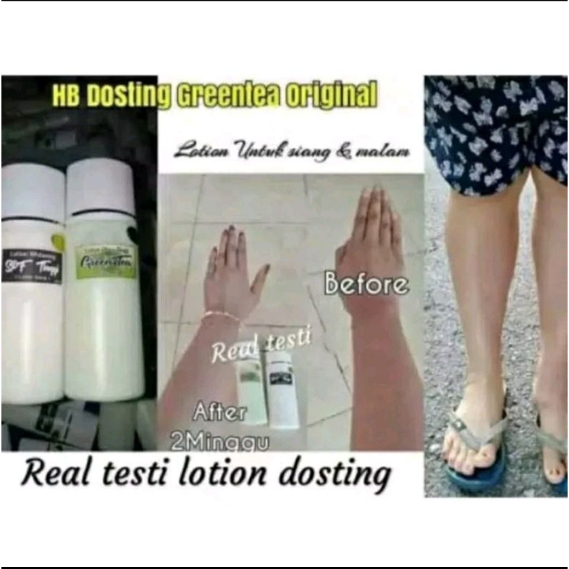 Hb Greentea Dosis Tinggi Pemutih Kulit Permanen Unisex Handbody Lotion Dosting Siang Dan Malam Peket