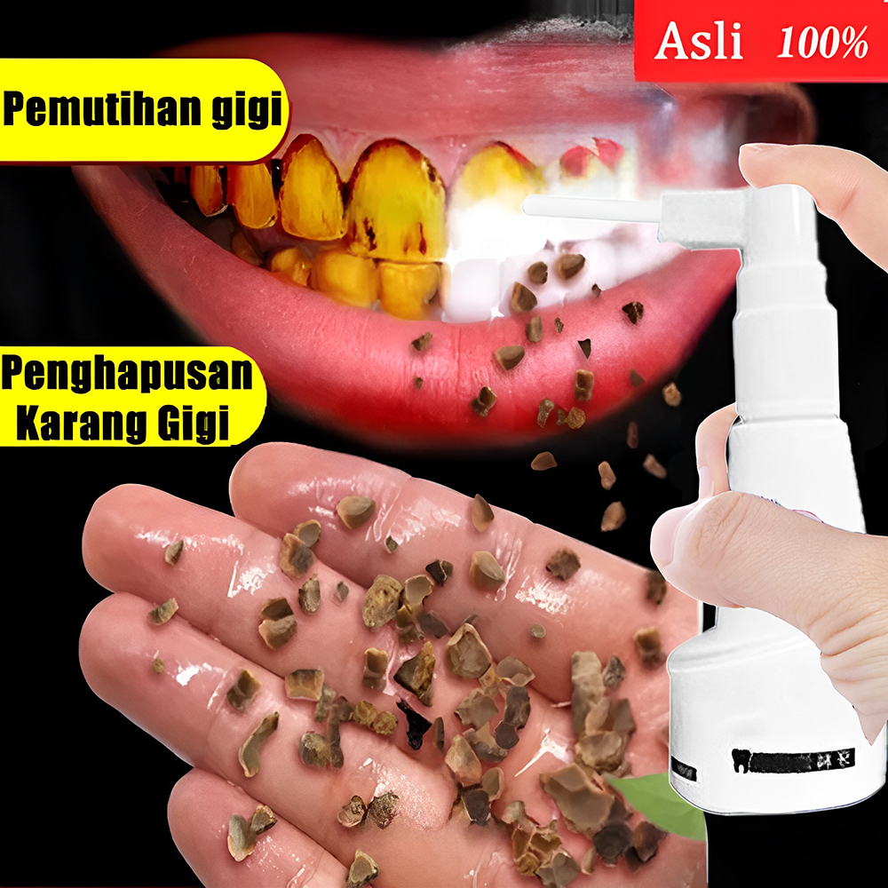 penghilang karang gigi perontok karang gigi odol pemutih gigi dan karang gigi scaling karang gigi pe