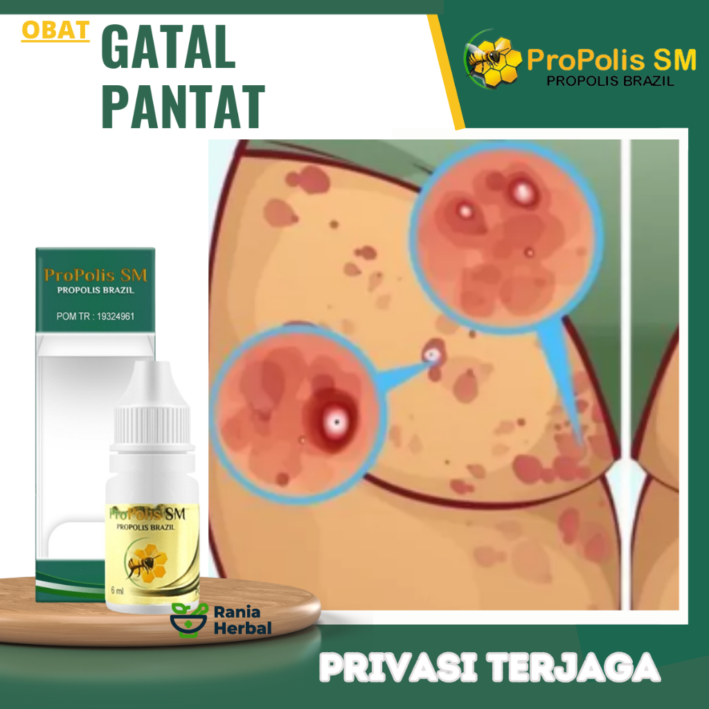 Obat Gatal Pantat, Obat Pantat Bruntusan, Obat Pantat Burik, Obat Bokong Bruntusan, Obat Penghilang 
