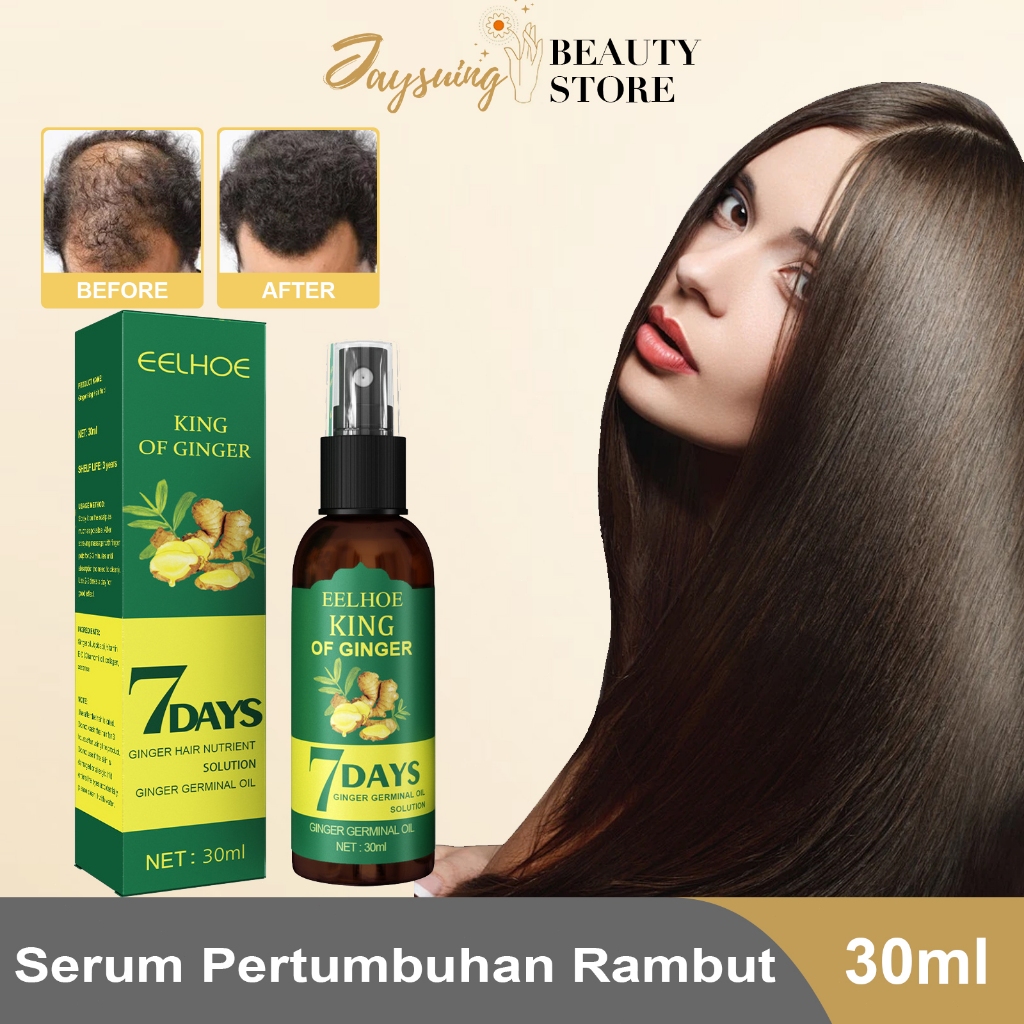 Eelhoe Semprotan Penumbuh Rambut Jahe Cairan Penumbuh Rambut Jahe Penumbuh Rambut Menutrisi Rambut M