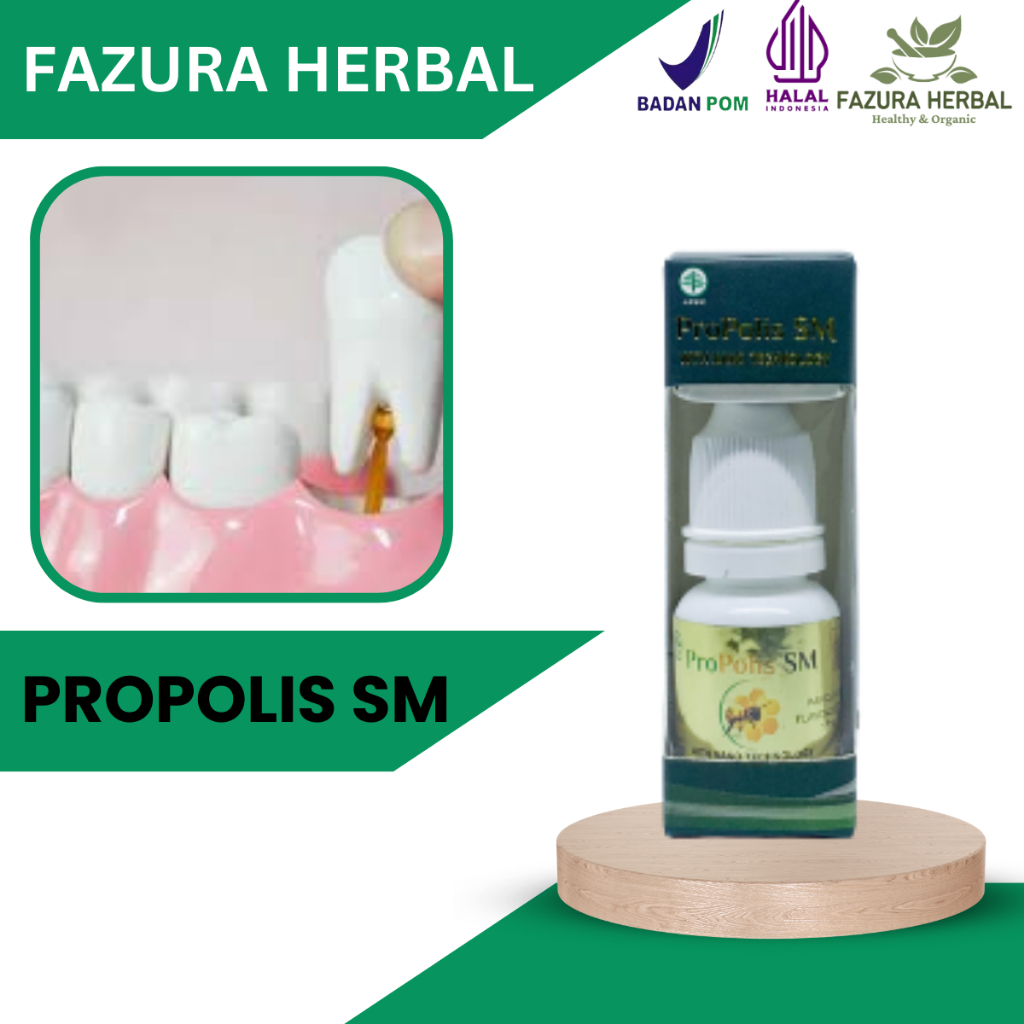 Propolis SM - Obat Gigi Goyang, Obat Gigi Berlubang Agar Copot, Obat Gigi Berlubang, Obat Gigi Ngilu